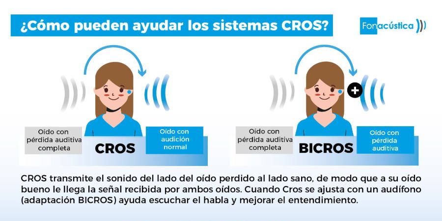 Ventajas del Sistema Cros - Fonacústica